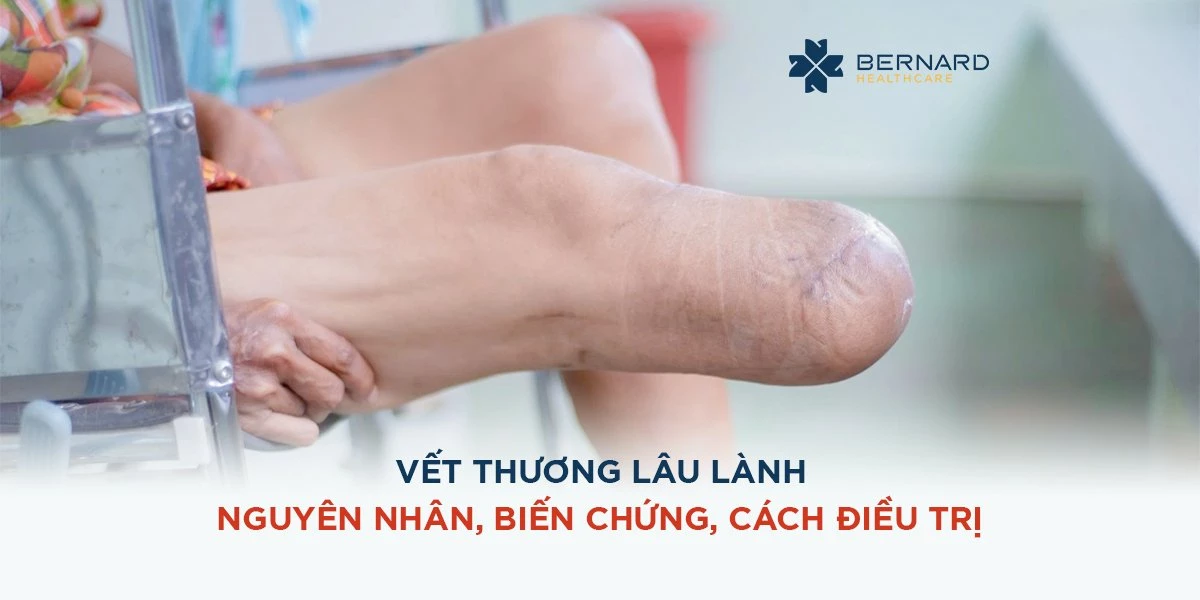 Loại củ nào sau đây có thể giúp cho vết thương mau lành và ít để lại sẹo?