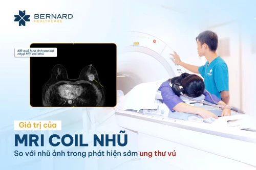 Giá trị của MRI Coil nhũ so với nhũ ảnh trong tầm soát phát hiện sớm ung thư vú