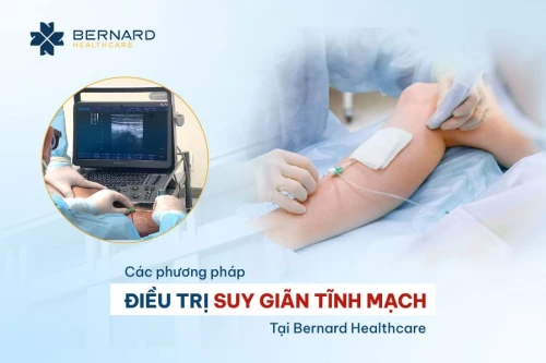 Các phương pháp điều trị chuyên sâu suy giãn tĩnh mạch tại Bernard Healthcare