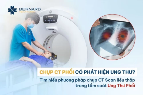 Chụp CT Phổi có phát hiện ung thư? Tìm hiểu phương pháp chụp CT Scan liều thấp trong tầm soát Ung Thư Phổi