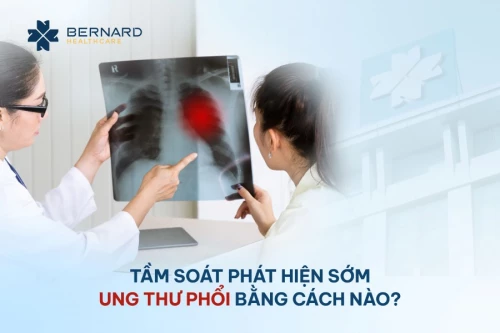 Tầm soát phát hiện sớm ung thư phổi bằng cách nào?