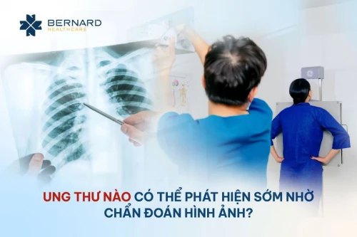 Ung thư nào có thể phát hiện sớm nhờ chẩn đoán hình ảnh?