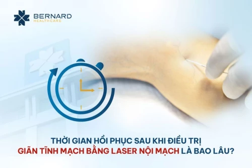 Thời gian hồi phục sau khi điều trị giãn tĩnh mạch bằng laser nội mạch là bao lâu?