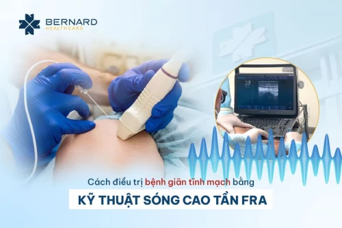 Cách điều trị bệnh giãn tĩnh mạch bằng kỹ thuật cao sóng cao tần RFA