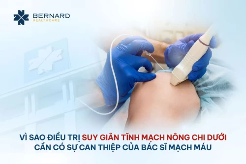 Vì sao điều trị suy giãn tĩnh mạch nông chi dưới cần có sự can thiệp của bác sĩ mạch máu