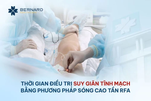 Thời gian điều trị suy giãn tĩnh mạch bằng phương pháp sóng cao tần RFA