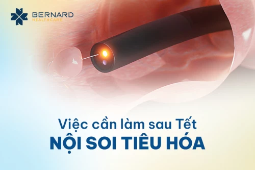 Việc cần làm sau tết: Nội soi tiêu hóa!