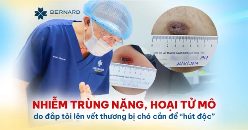 Nhiễm trùng nặng, hoại tử mô do đắp tỏi lên vết thương bị chó cắn để “hút độc”