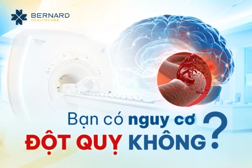 Bạn có nguy cơ bị đột quỵ?