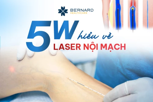 Laser nội mạch trong điều trị suy giãn tĩnh mạch chi dưới