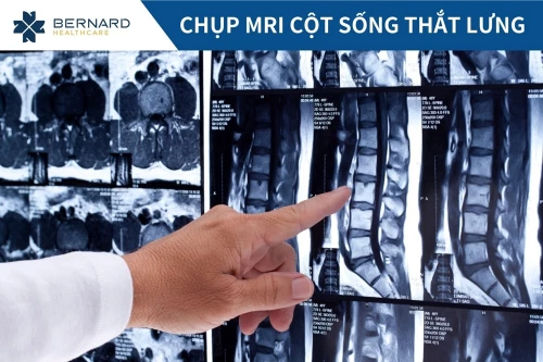 Chụp MRI cột sống thắt lưng