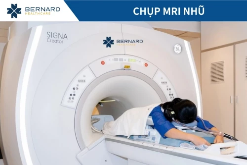 Chụp MRI nhũ