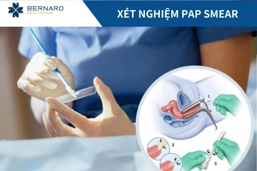 Xét nghiệm Papsmear