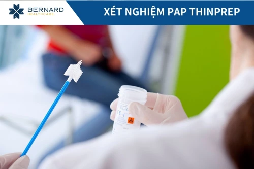 Xét nghiệm Thinprep Pap