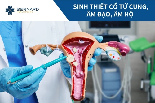 Sinh thiết cổ tử cung, âm đạo, âm hộ