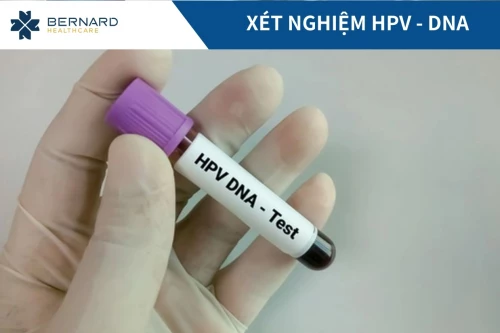 Xét nghiệm HPV-DNA