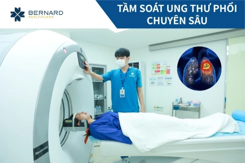 Tầm soát ung thư phổi chuyên sâu