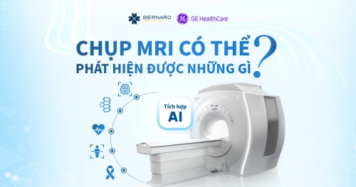 Chụp MRI giúp phát hiện những vấn đề sức khỏe nào? Ai nên chụp MRI?