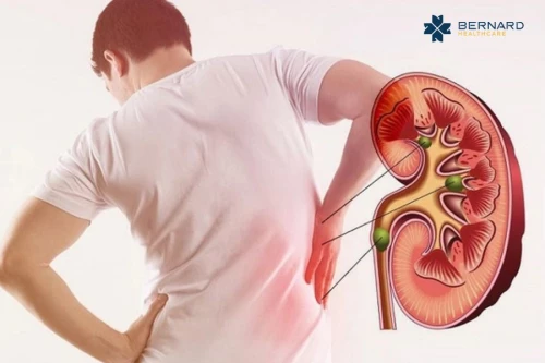 Đái tháo đường gây biến chứng đa cơ quan