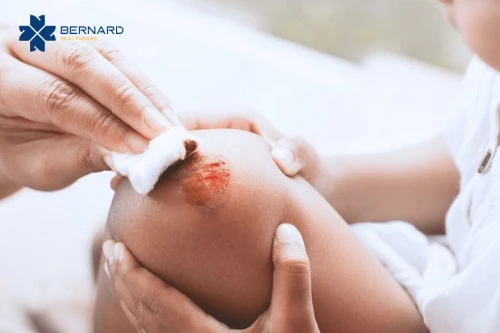 Vết thương ở trẻ: Khi nào cha mẹ nên đưa con đi khám để tránh nhiễm trùng và sẹo xấu?