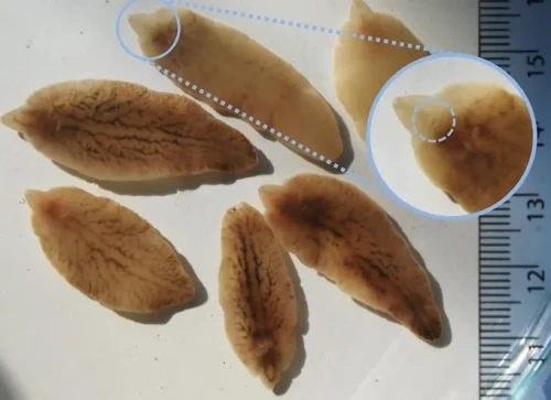 Q&A: Sán lá gan lớn là gì? Có nguy hiểm không?