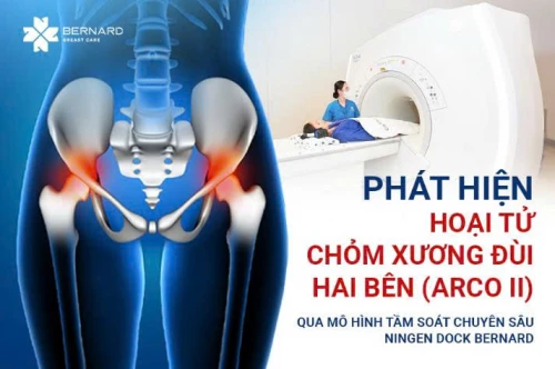 Phát hiện hoại tử chỏm xương đùi hai bên (ARCO II) qua mô hình tầm soát chuyên sâu Ningen Dock tại Bernard Healthcare