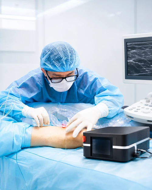 Đơn vị Mạch máu - Điều trị Suy giãn tĩnh mạch