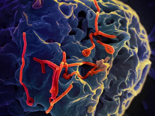 Sở Y tế TP.HCM: Chủ động giám sát, ngăn chặn nguy cơ xâm nhập của dịch bệnh Ebola