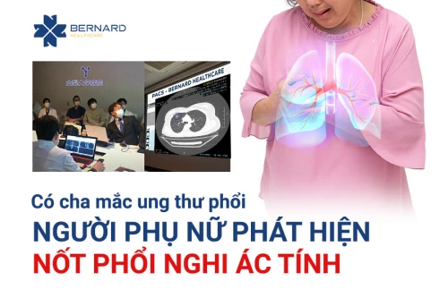 Có cha mắc ung thư phổi, người phụ nữ phát hiện nốt phổi nghi ác tính