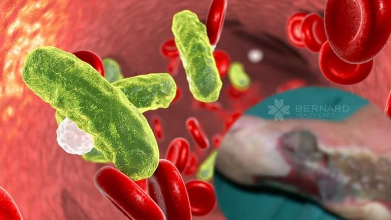 Mô phỏng vi khuẩn xâm nhập vào máu gây nhiễm trùng huyết và hình chụp thực tế một vết thương nhiễm trùng nặng
