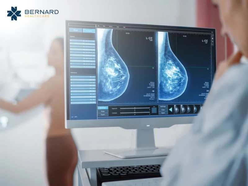 Hình ảnh chụp X-quang tuyến vú giúp bác sĩ theo dõi những dấu hiệu bất thường